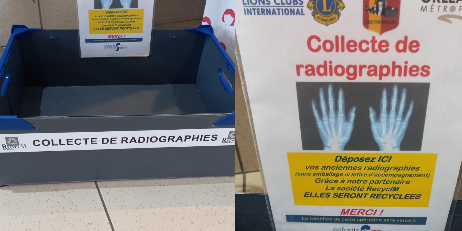 Collecte des anciennes radiographies